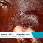 CeraVe - Gel Moussant Anti-Imperfections - Purifie la peau en douceur et réduit les imperfections - Acide salicylique, argile blanche, céramides et niacinamide - Peau à tendance acnéique