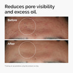 The Ordinary Niacinamide 10% + Zinc 1%, sérum éclat et lissant pour peaux à imperfections, 30 ml